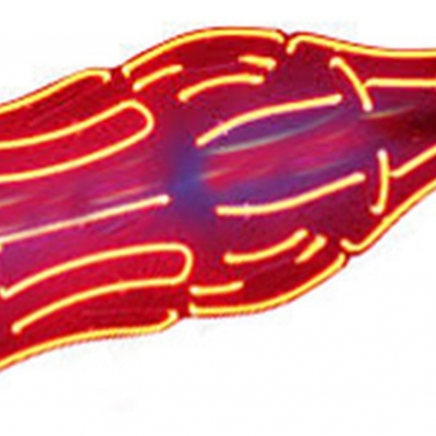 Coca